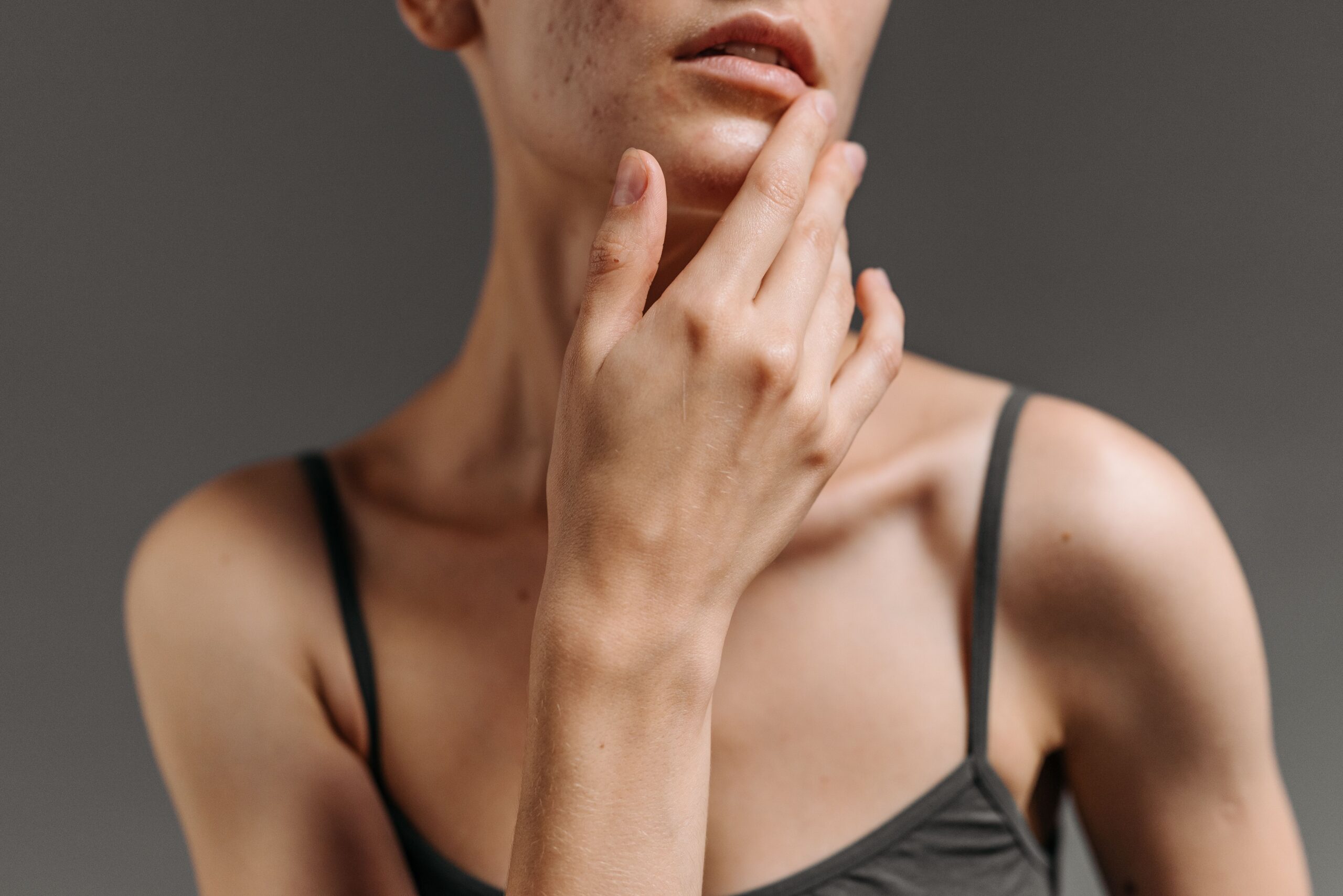 Rhinoplastie, profil